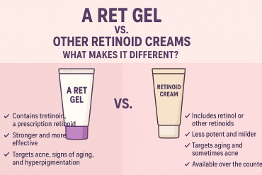 Comparison infographic showing A Ret Gel versus other retinoid creams, highlighting differences in potency, effectiveness, and availability