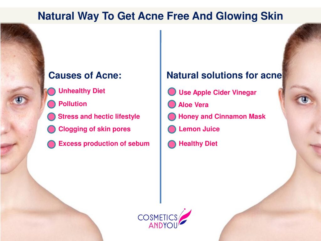 Natural Way to Get Acne Free And Glowing Skin – Cosmetics and you ...