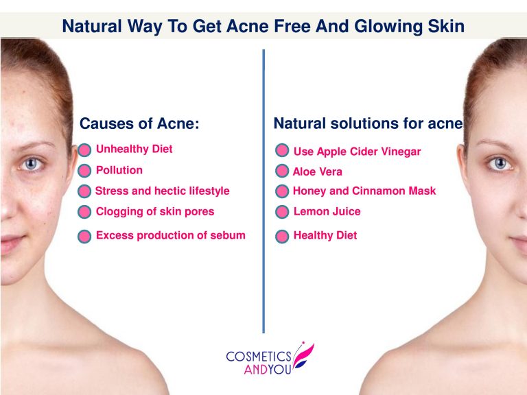 Natural Way to Get Acne Free And Glowing Skin Cosmetics and you