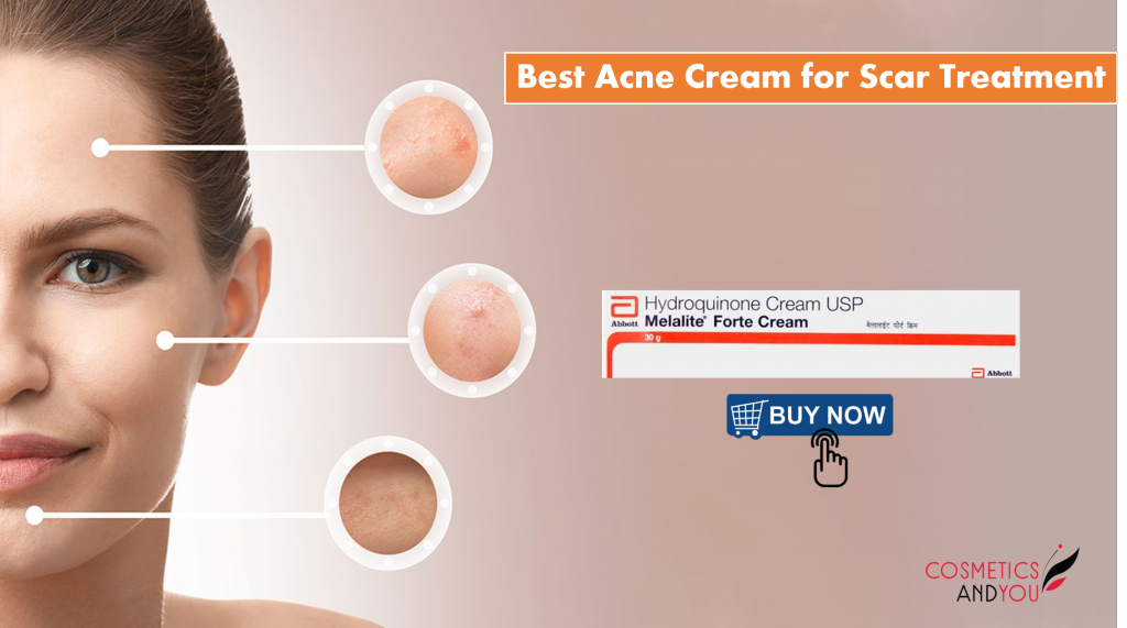 Kojic Acid Cream Cosmetics and you Acne Treatment, Careprost Eyelashes, Careprost, Skin Care