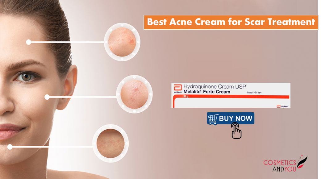 Acne Cream for Scar Treatment