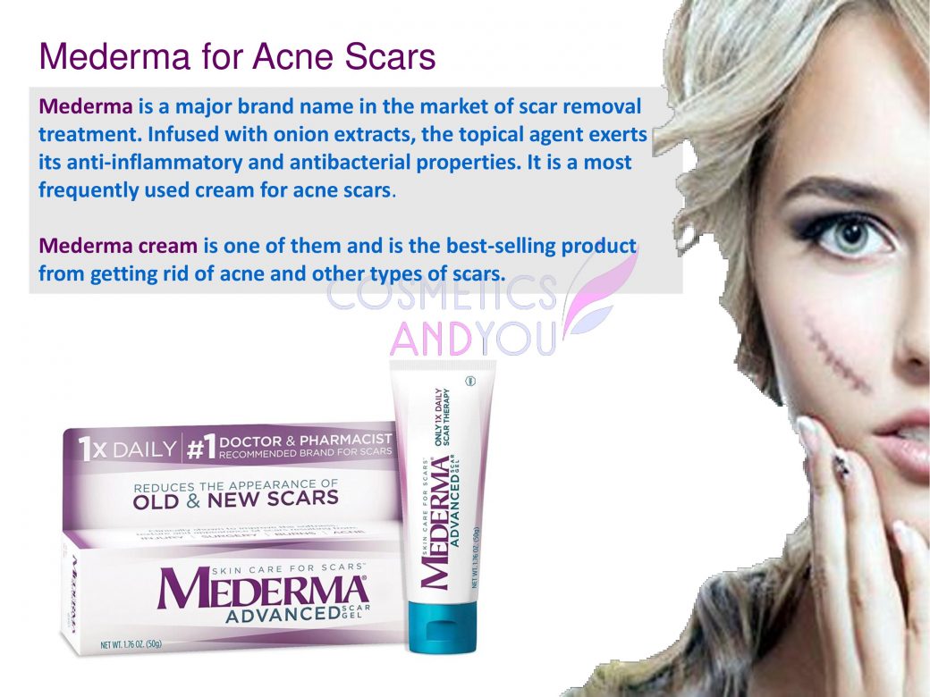 Can Mederma be used for Acne Scars Cosmetics and you Acne Treatment