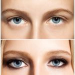 Eflora Cream vs Vaniqa: The Ultimate Comparison Guide for Women with Hirsutism