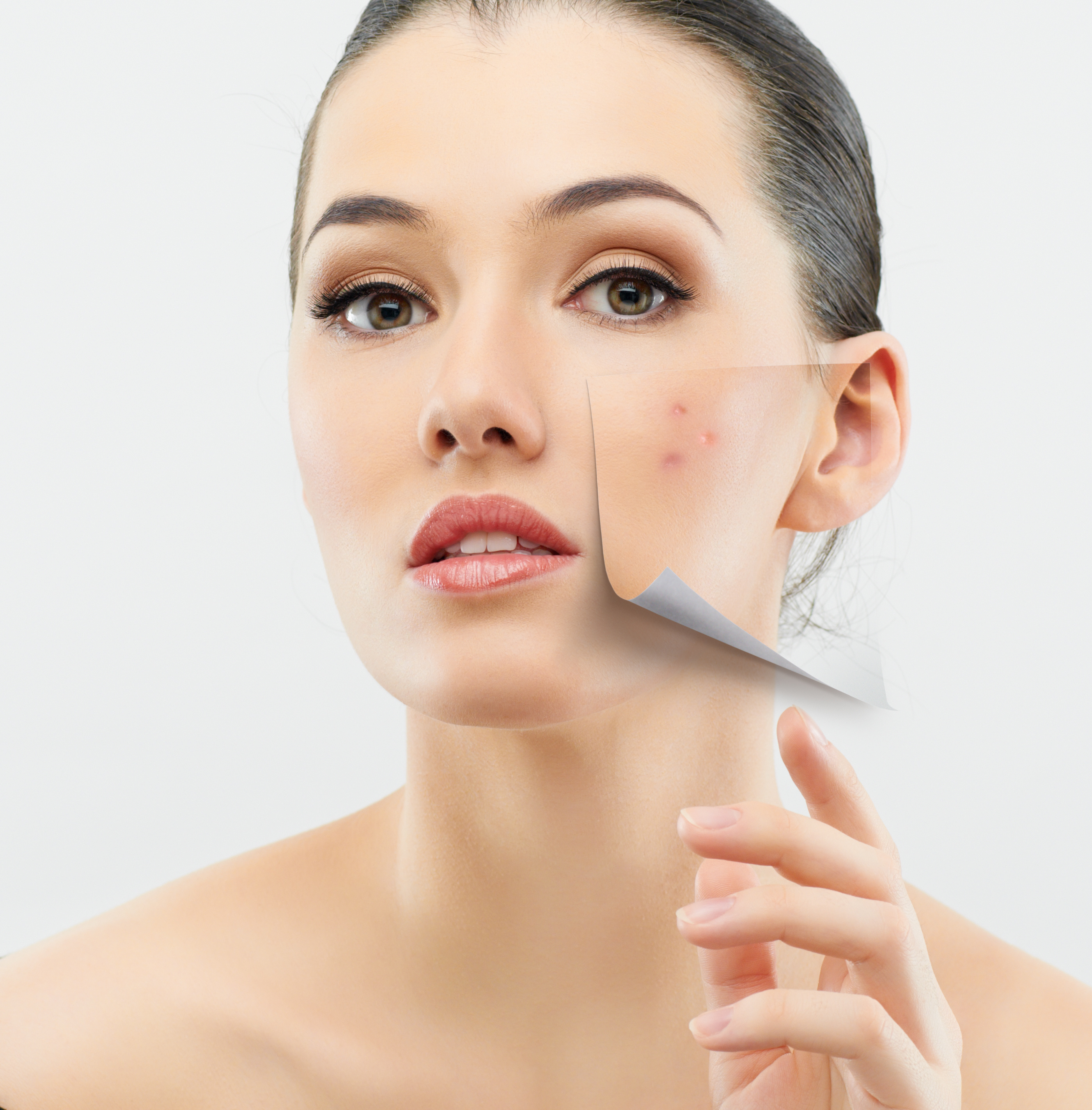 tazarotene for wrinkles