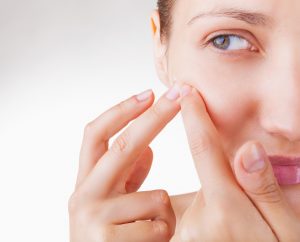 Benzoyl Peroxide for Acne and How Does it Work