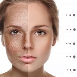 Understanding tretinoin strengths:0.025%, 0.05%, and 0.1%