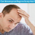 Can Bimatoprost Regrow Scalp Hair?