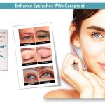 Enhance Eyelashes With Careprost