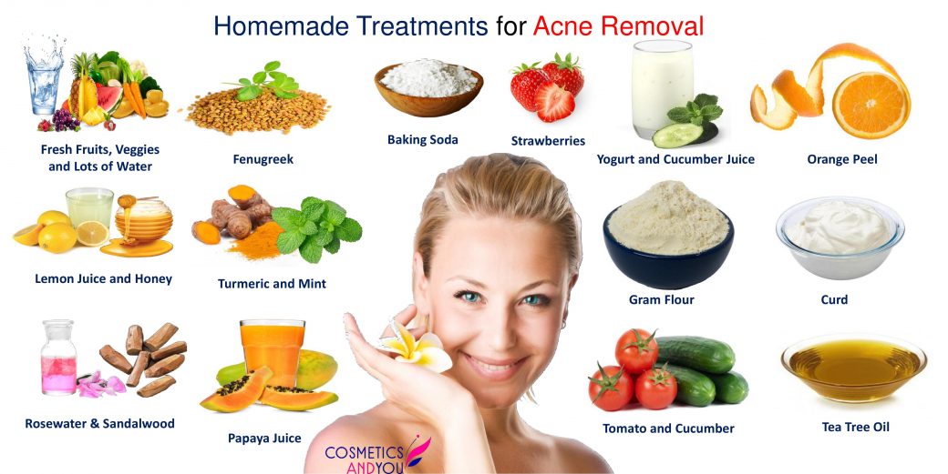 15 Homemade Treatments for Acne Removal – Cosmetics and you : Acne ...