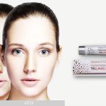 What Is Tri-Luma Cream? Uses, Benefits, Side Effects, and Expert Tips