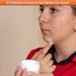 Is Tretinoin Cream or Gel Better for Acne?