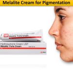 Melalite Cream for Pigmentation