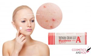 Tretinoin Cream 0.025 for Acne