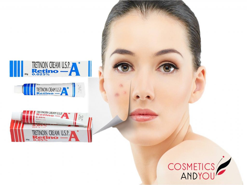 Tretinoin Cream for Acne Removal – Cosmetics and you : Acne Treatment
