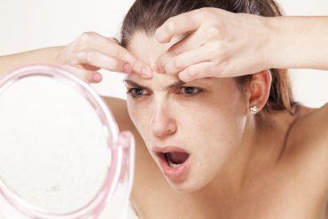 Risk Factors of Acne