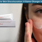 Tri-Luma for Skin Discolouration: A Game-Changer in Skincare