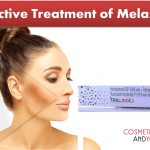 Tri-Luma Cream vs Regular Skin-Lightening Creams: Which One Is Better for Melasma and Dark Spots?