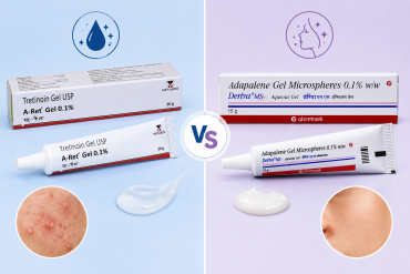 Adapalene vs Tretinoin Gel: Compare two widely used topical retinoids for acne treatment and skin renewal.