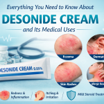 Everything About Desonide Cream and Its Medical Uses Everything About Desonide Cream and Its Medical Uses