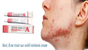 Tretinoin cream