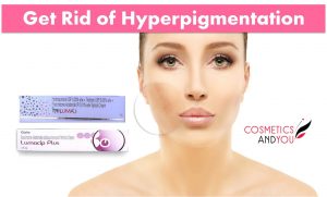 How to get rid of Hyperpigmentation