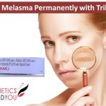What Is Tri-Luma Cream? Uses, Benefits, Side Effects, and Expert Tips