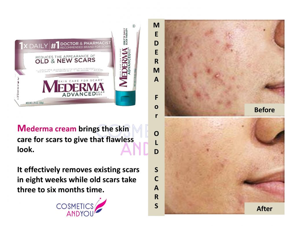 Mederma Reviews For Old Scars Cosmetics And You Acne Treatment mederma-reviews-for-old-scars-cosmetics-and-you-acne-treatment