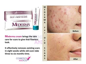 Mederma Reviews for Old Scars, mederma for scars