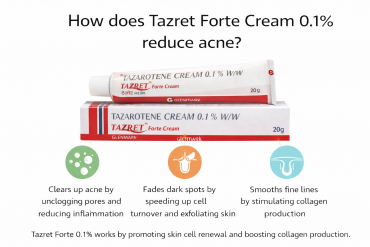 Tazret Forte Cream 0.1% tazarotene cream for acne treatment and pore unclogging